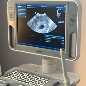 УЗИ диагностика беременности